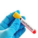 Lipid Profile (8 Lab Tests)